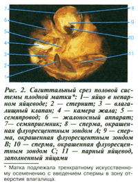 срез половой системы плодной матки