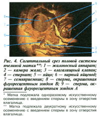 Срез половой системы плодной матки