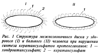 Структура межпозвоночного диска