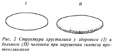 Структура хрусталика